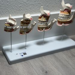 3B Scientific Dentition Development Model - 4 Stages Dental Teeth Development Education Model