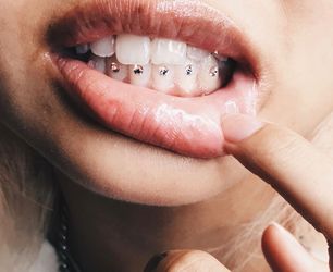 Tooth Gem