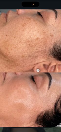 Facial BB glow