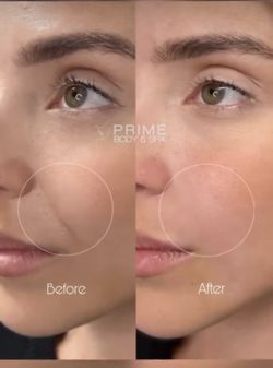 Tratamientos De Belleza