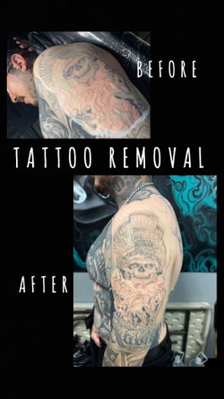 Removal