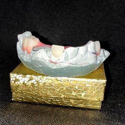 We Replace Missing Teeth