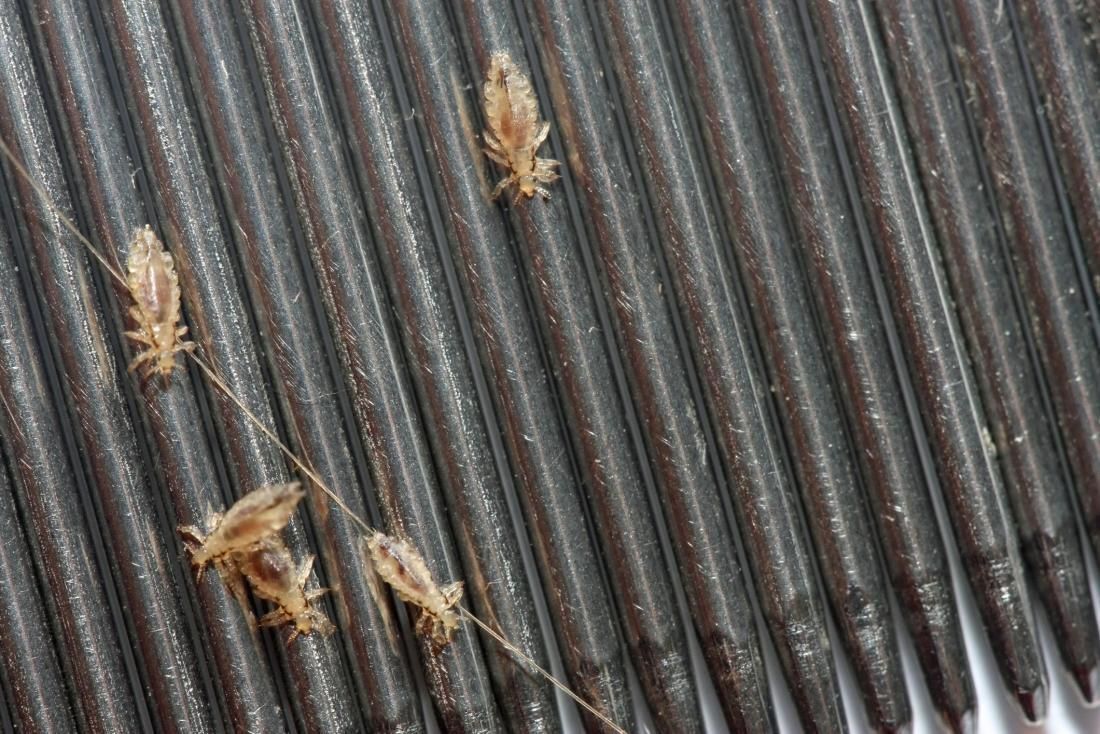 Got Lice? Lice Comb/Lice Shampoo