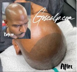Scalp Micro Pigmentation Special $900