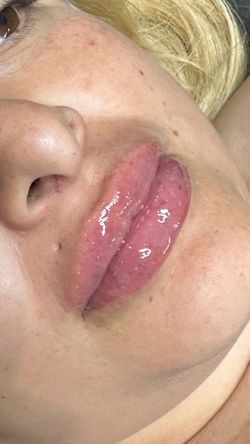 Lips