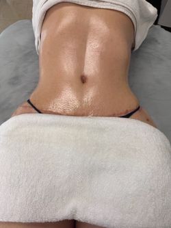 Post-op massage