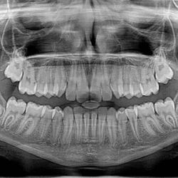 15 Years exprience in Dental 
