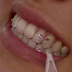 Tooth Gems