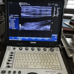 GE LOGIQ E 2013 B12 (R7.0.3) PORTABLE ULTRASOUND w/ ONE PROBE.