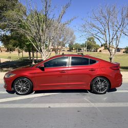 2018 Hyundai Elantra