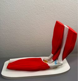 STRATA 3D Prints - Elbow Anatomy Model