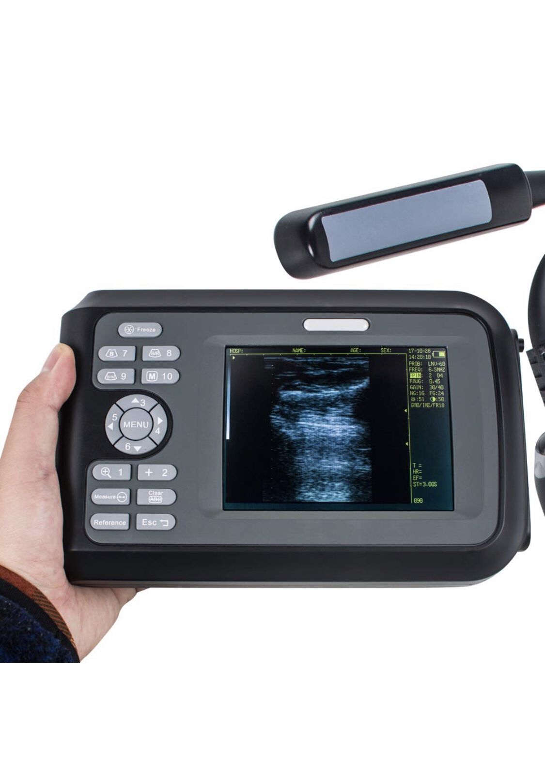 Veterinarian Portable Ultrasound Scanner