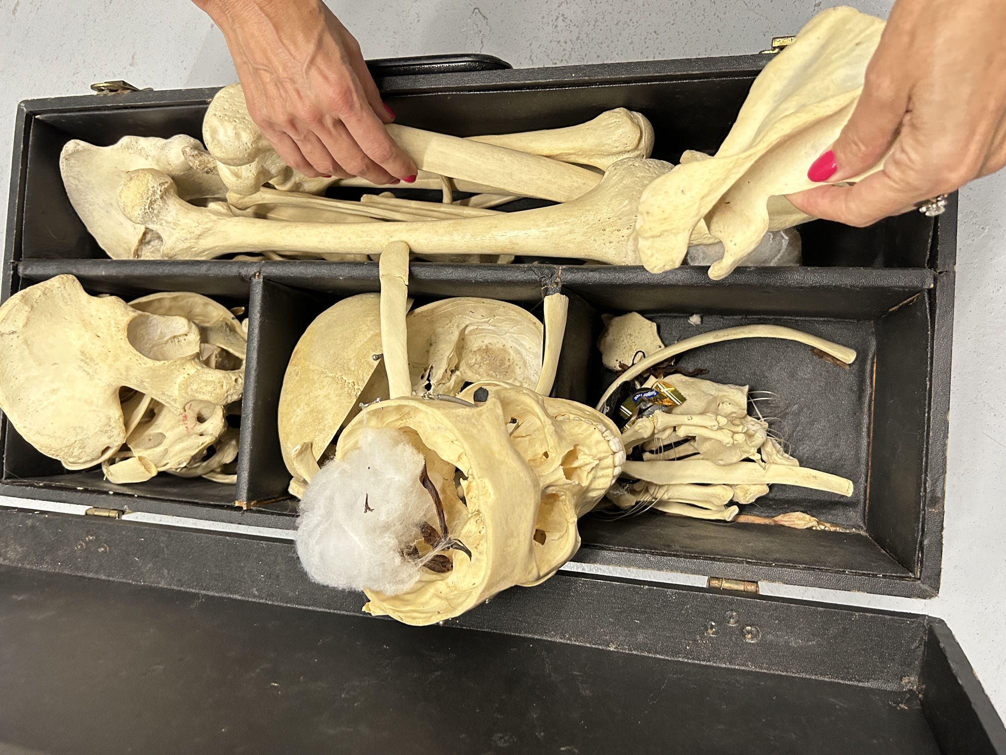 A Real Skeleton For Halloween 