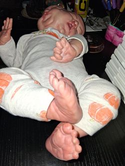 Siamese twin babies