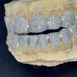 Vvs And Vs1 Diamond And Gold Grillz