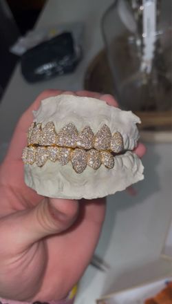 Custom Moissanite Grills