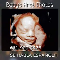 3D 4D HD Baby's Ultrasounds
