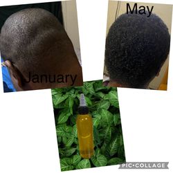 Homemade Hair Growth Oil