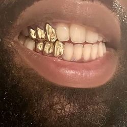 Gold grill