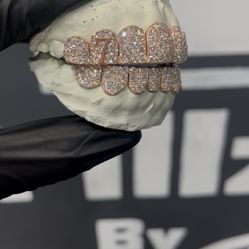 VVS Grillz
