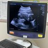 Andrew