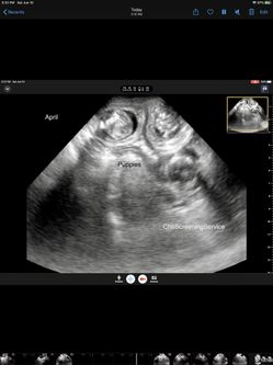 Ultrasound