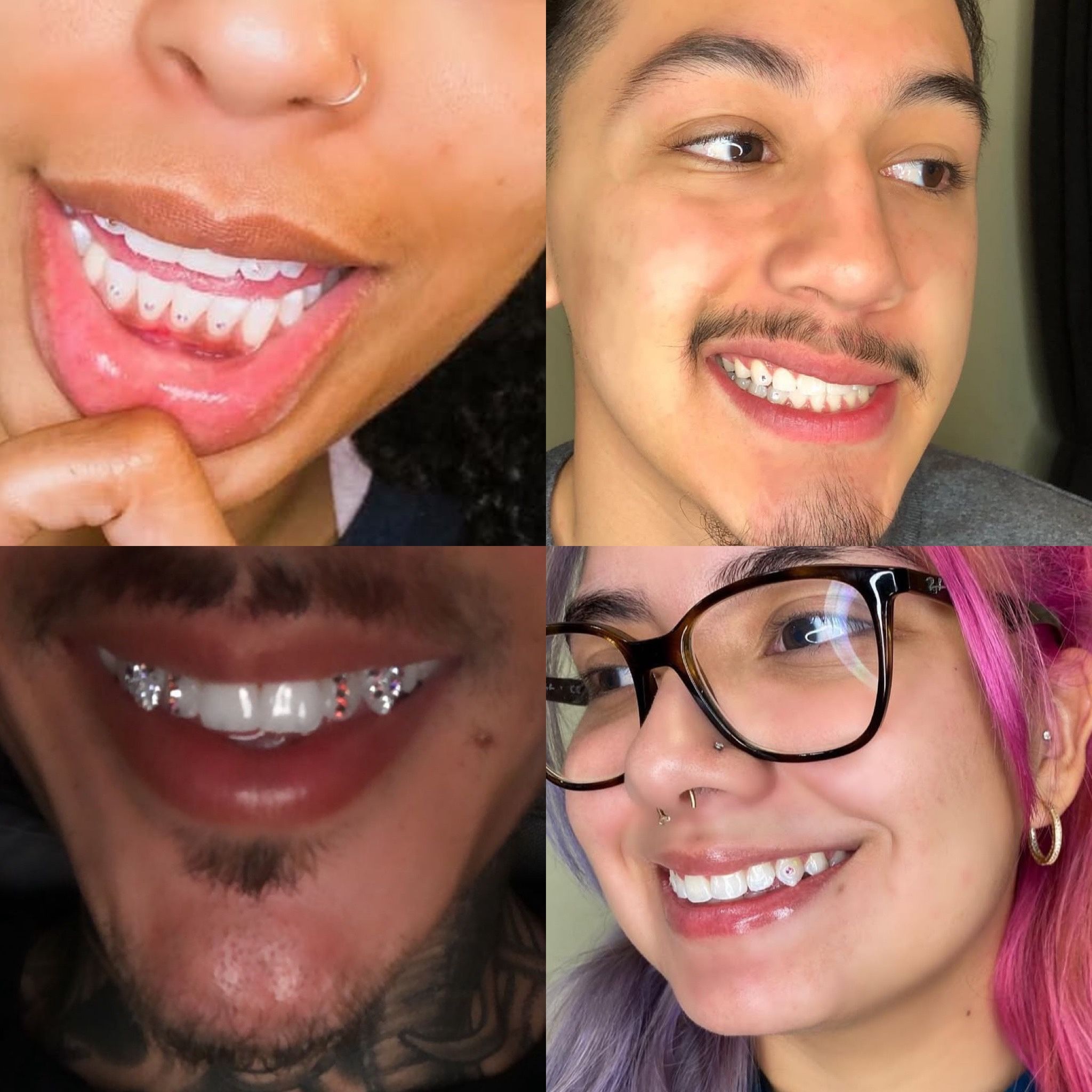 Tooth Gems