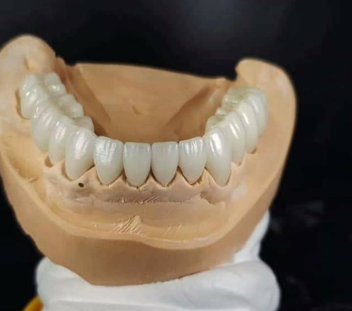 Zirconia Parciales