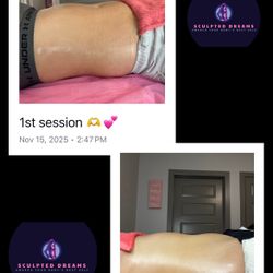 Body Sculpting 