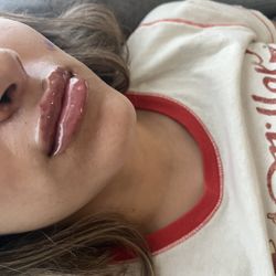 Lip Filler 