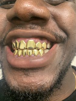 Gold teeth gold grillz