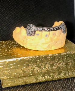 Custom Gold Grillz
