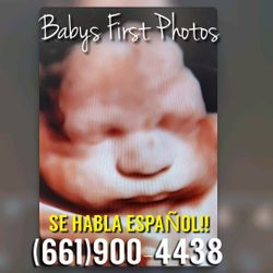 3D 4D HD Baby Ultrasounds!!