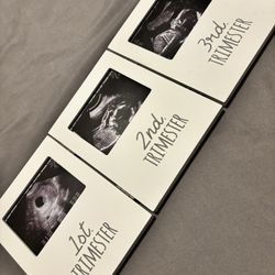 Ultrasound Picture Frame