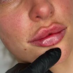 Beautiful LIPS 😍👄 