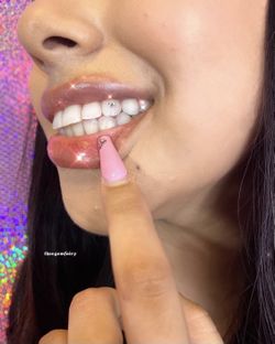 Tooth gems