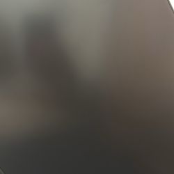 Amazon Basics 24 Inch Monitor Powered with AOC Technology, FHD 1080P, 75hz, VESA