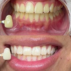 Instant Results !