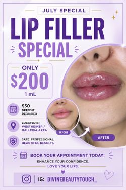 Lip Filler