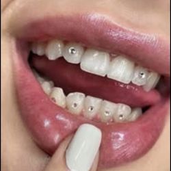 Teeth Gems. Let Your Smile Shine.  