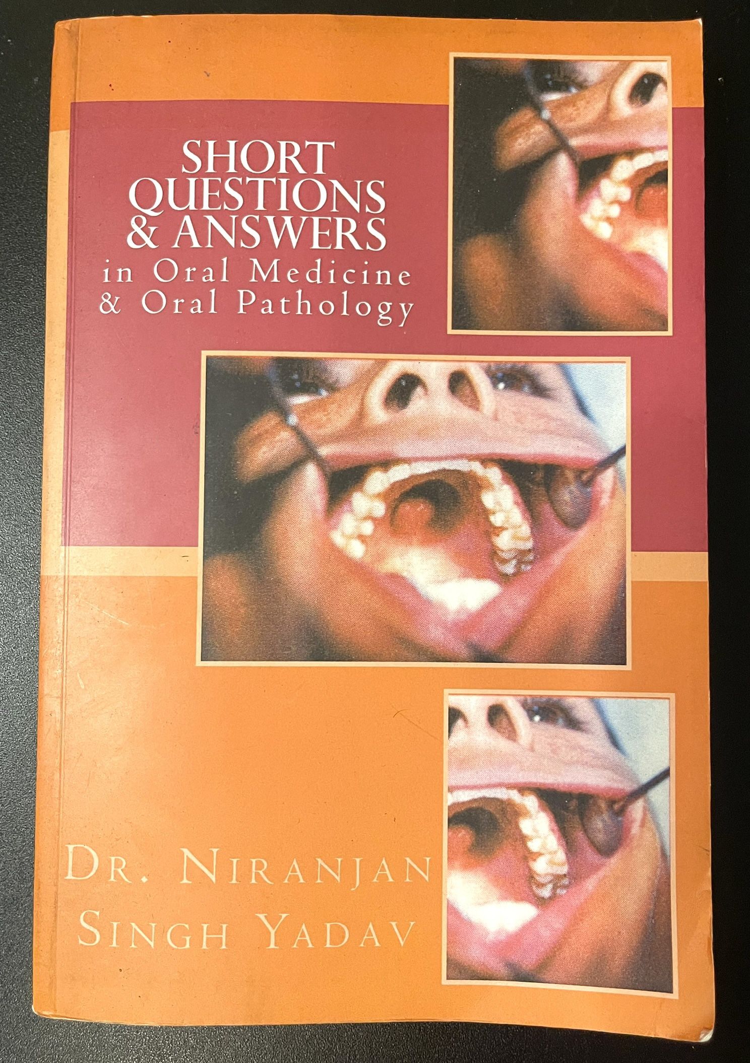 SHORT QUESTIONS & ANSWERS in Oral Medicine & Oral Pathology by Dr. NIRANJAN SINGH YADAV