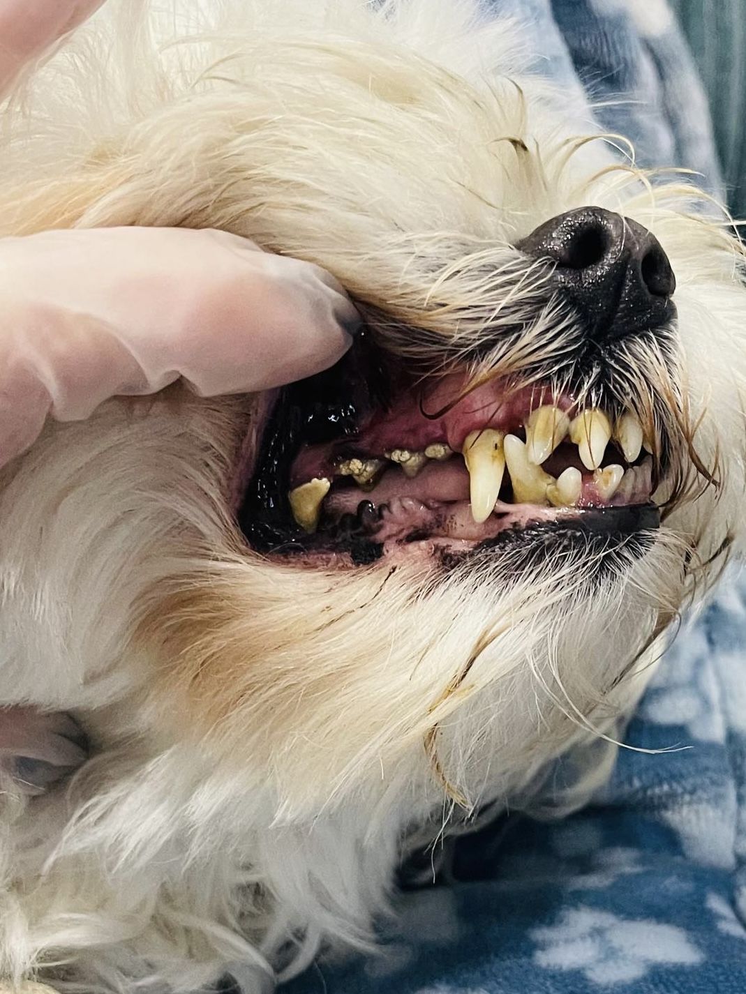 Dental cleaning