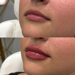 Lip special