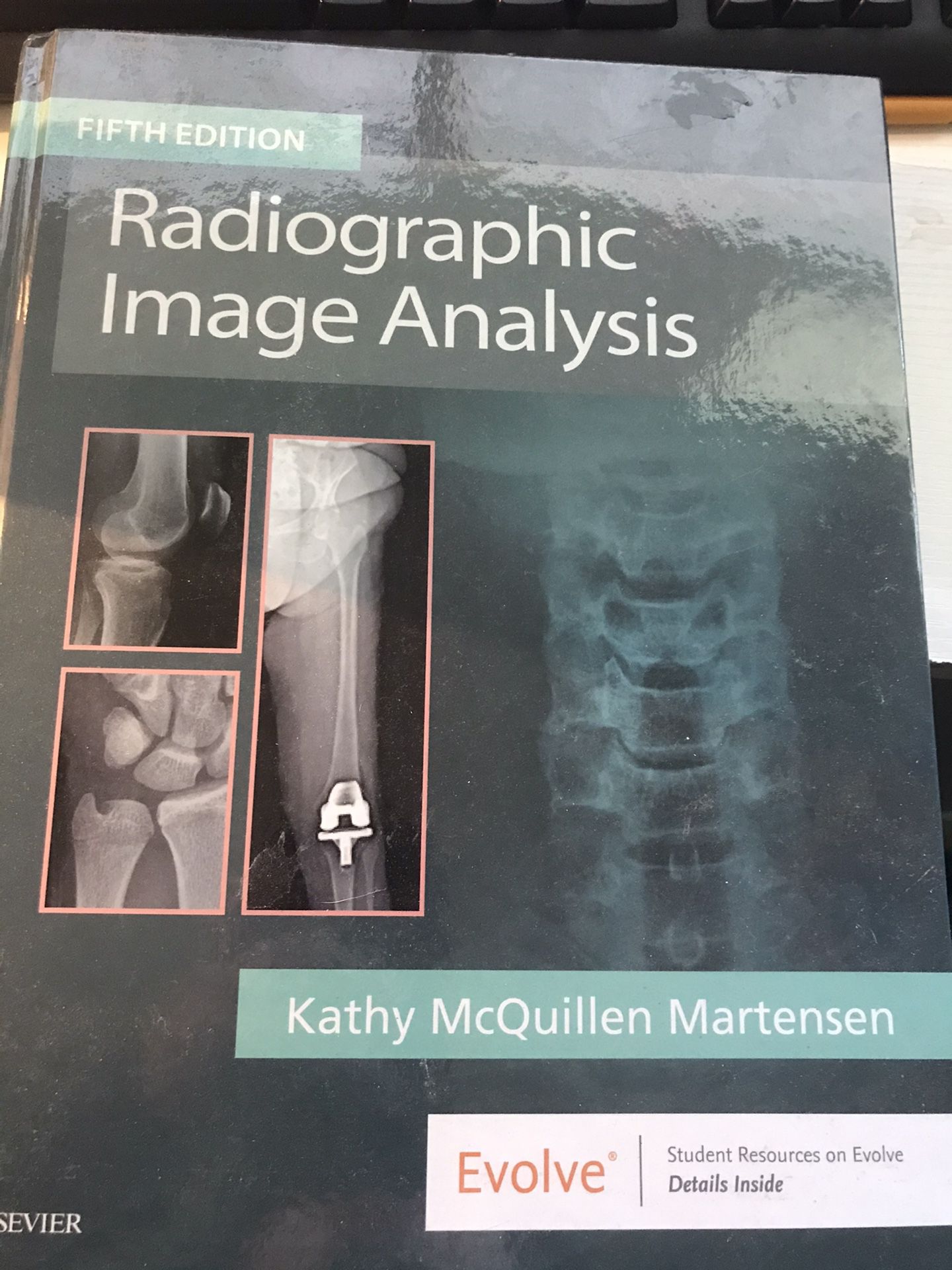 Radiographic Image Analysis. Radiology Tech School