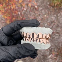 Grills Gold/Iced Out