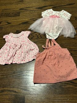 3 different baby dresses