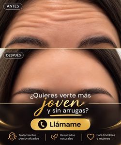 Belleza