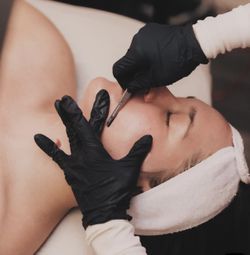 DERMAPLANING