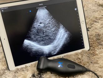Ultrasound