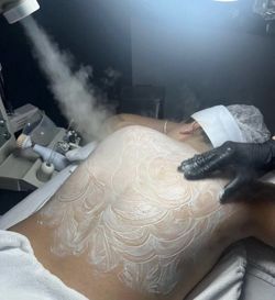 Facial